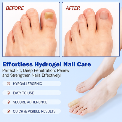 Fungal Nail Patch Treatment