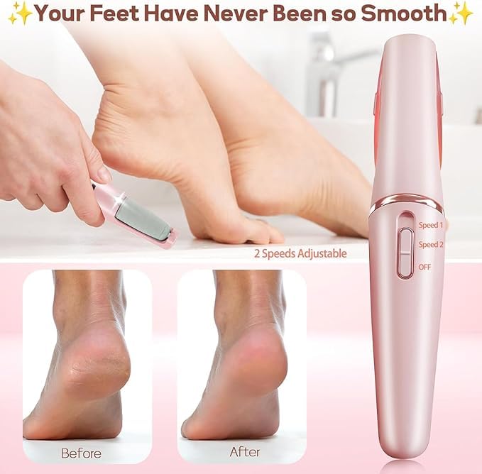 Electric Foot File Hard Skin Remover for Calluses