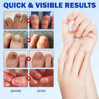 Fungal Nail Patch Treatment